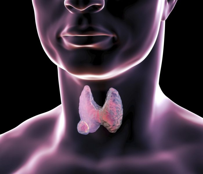 Thyroid cancer: what is the danger and how is it treated?
