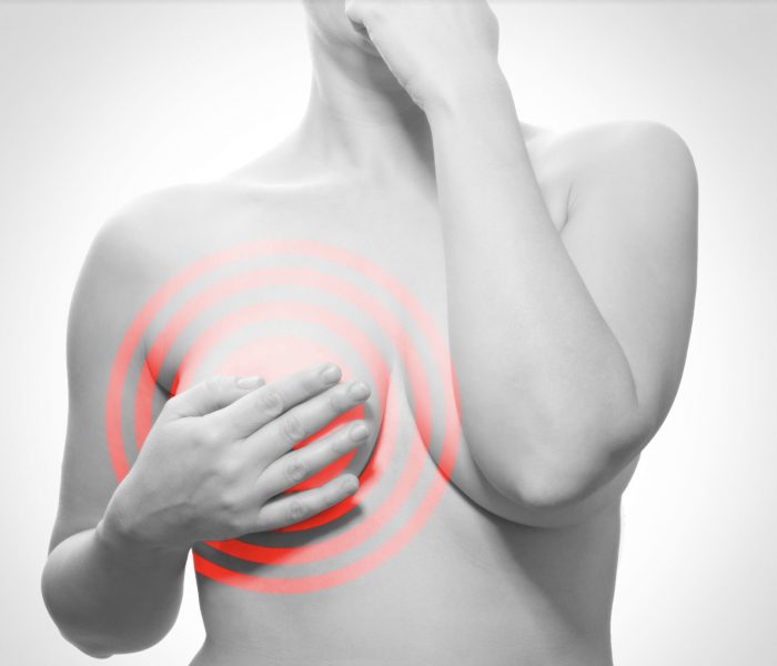 Nipple cancer: how is it manifested, diagnosed and treated?