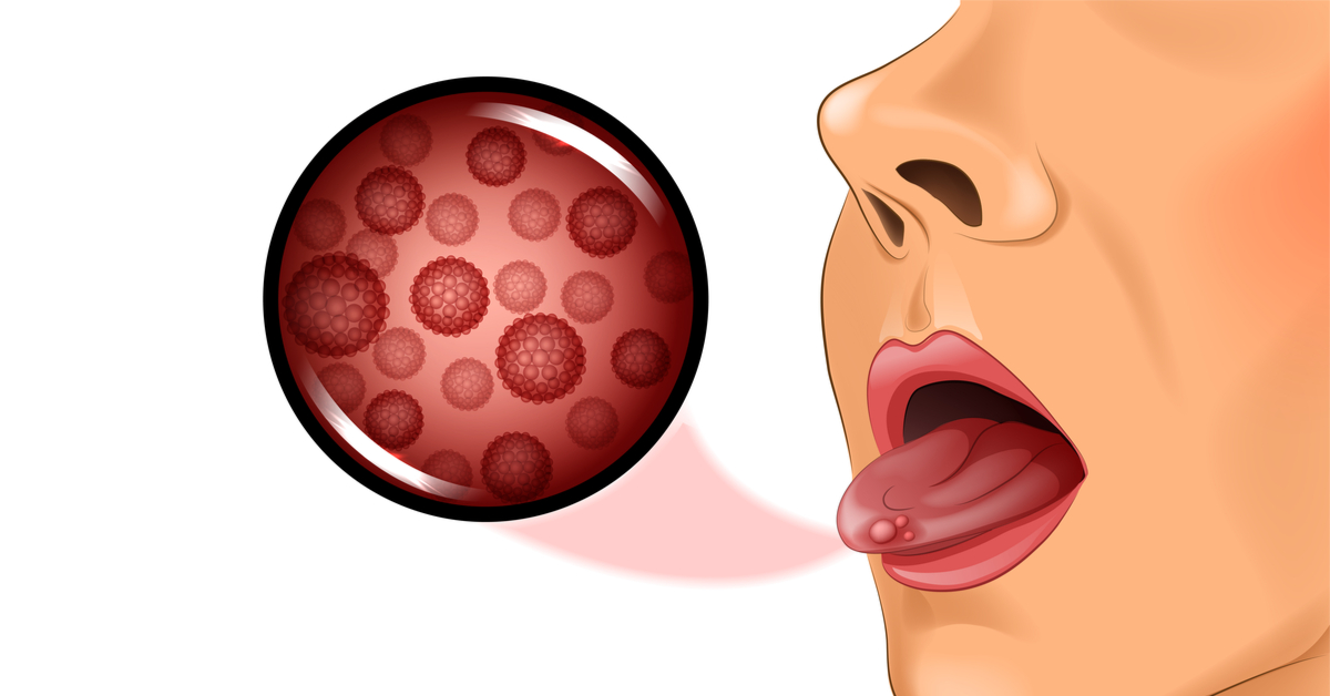 What is tongue cancer and how is it dangerous?